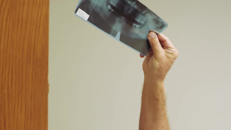 Wisdom Teeth Removal Near Me